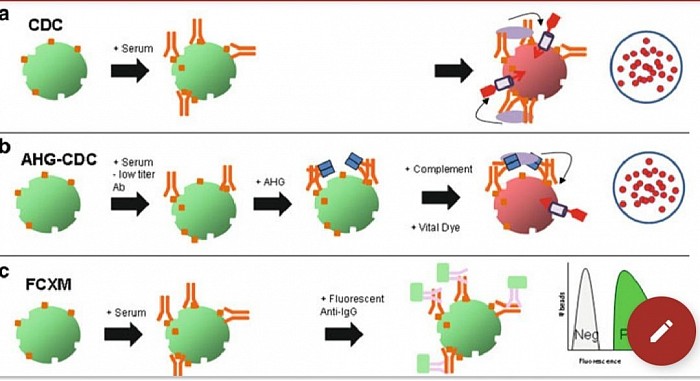 Classifications of Transplant kingdom.