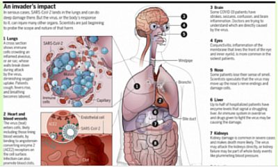 PANDEMIC,  as a Chronic Kidney Disease patient, what should you do.  Coronavirus (COVID-19) guidance for patients with kidney disease